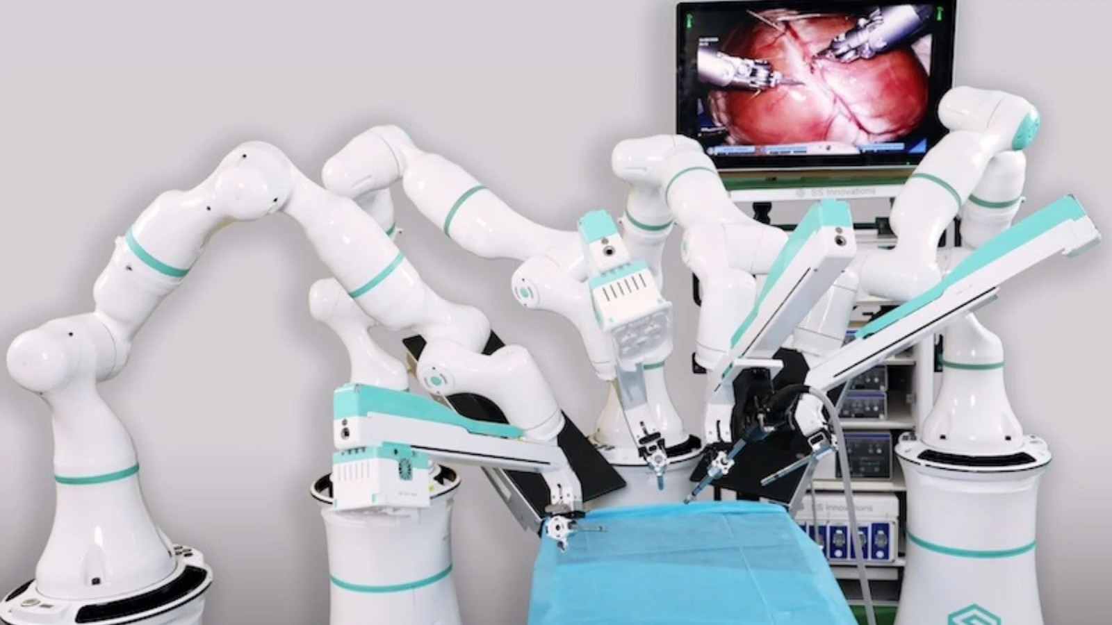 Multi-arm robotic surgery system with 3D surgical console view, as used for robotic surgery in Delhi NCR