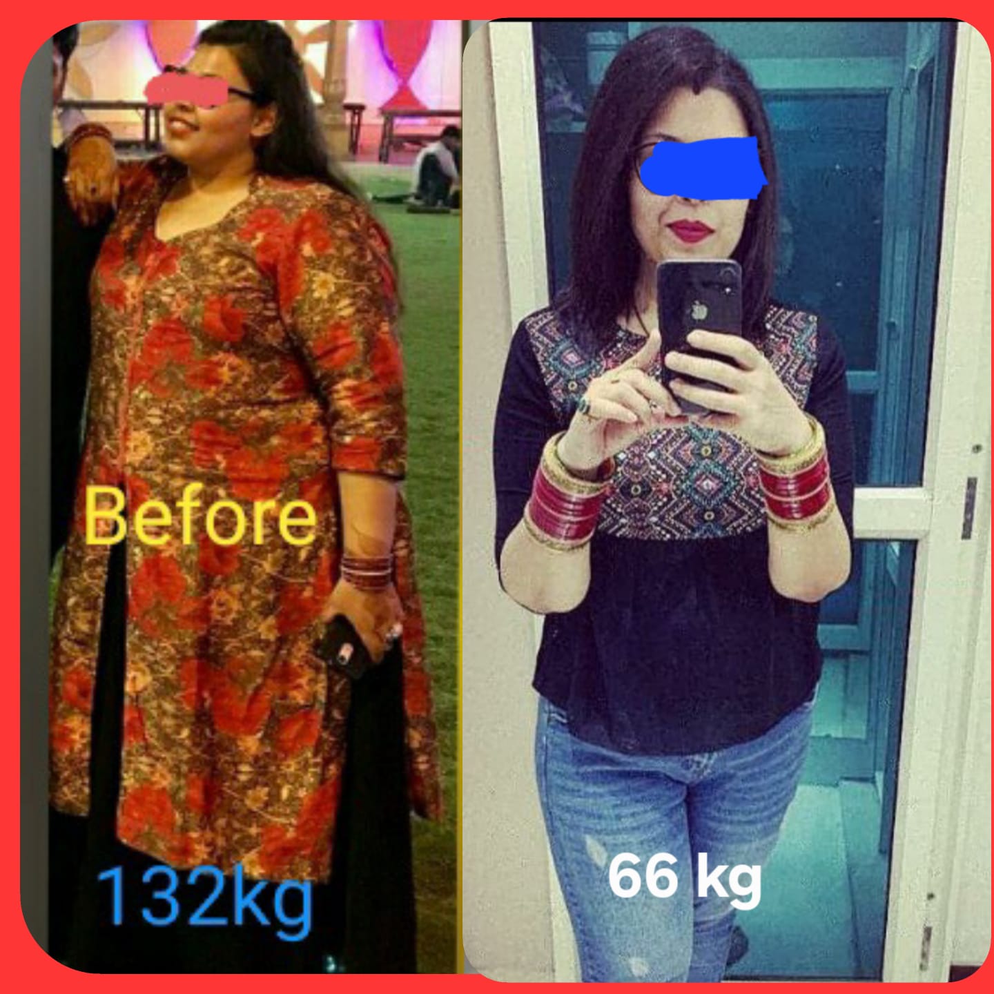 Before and after photos of a Novo bariatric patient, from 132 kg to 66 kg