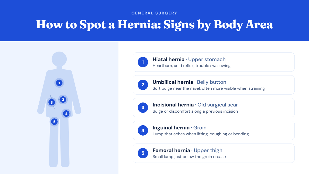Body diagram showing where five common hernias appear: hiatal hernia in the upper stomach, umbilical hernia at the belly button, incisional hernia along an old surgical scar, inguinal hernia in the groin, and femoral hernia in the upper thigh